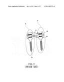 METHOD FOR GUIDING SYMMETRIC IMPLANTATION OF BONE SCREWS diagram and image