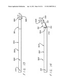 METHOD AND APPARATUS FOR PERFORMING MINIMALLY INVASIVE CARDIAC PROCEDURES diagram and image