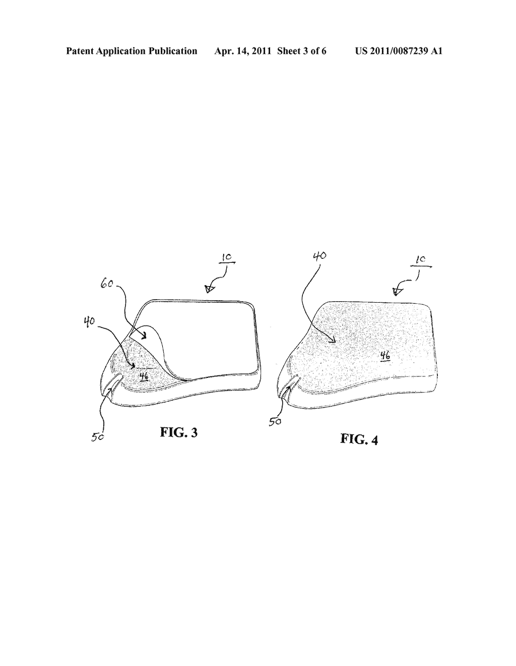 Device for Hygienic Extraction of an Acne Related Impaction - diagram, schematic, and image 04