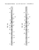  Clip Advancer diagram and image