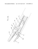  Clip Advancer diagram and image