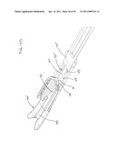  Clip Advancer diagram and image