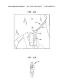  Clip Advancer diagram and image