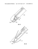 Suturing Apparatus and Method diagram and image