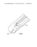 Suturing Apparatus and Method diagram and image