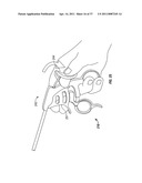 Suturing Apparatus and Method diagram and image