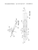 Suturing Apparatus and Method diagram and image