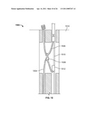 TISSUE LIGATION DEVICES AND CONTROLS THEREFOR diagram and image