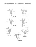 TISSUE LIGATION DEVICES AND CONTROLS THEREFOR diagram and image