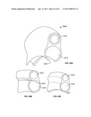 TISSUE LIGATION DEVICES AND CONTROLS THEREFOR diagram and image