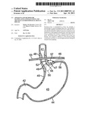 APPARATUS AND METHOD FOR MANIPULATING STOMACH TISSUE AND TREATING GASTROESOPHAGEAL REFLUX DISEASE diagram and image