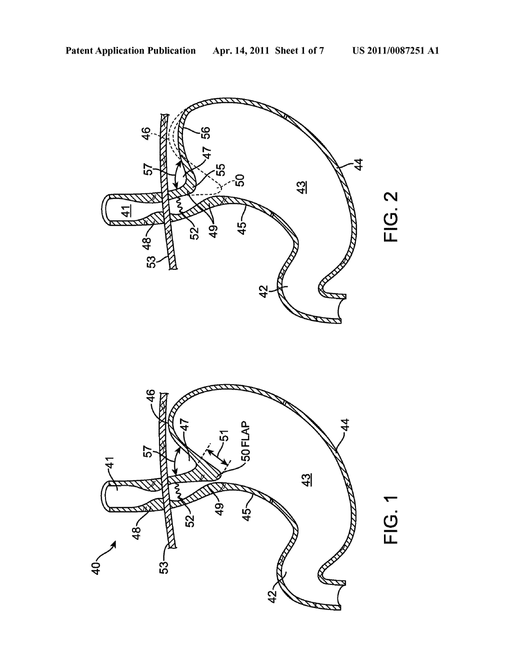 APPARATUS AND METHOD FOR MANIPULATING STOMACH TISSUE AND TREATING GASTROESOPHAGEAL REFLUX DISEASE - diagram, schematic, and image 02