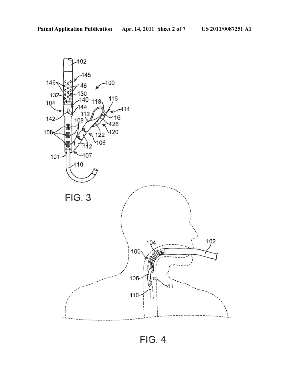 APPARATUS AND METHOD FOR MANIPULATING STOMACH TISSUE AND TREATING GASTROESOPHAGEAL REFLUX DISEASE - diagram, schematic, and image 03