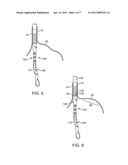 APPARATUS AND METHOD FOR MANIPULATING STOMACH TISSUE AND TREATING GASTROESOPHAGEAL REFLUX DISEASE diagram and image