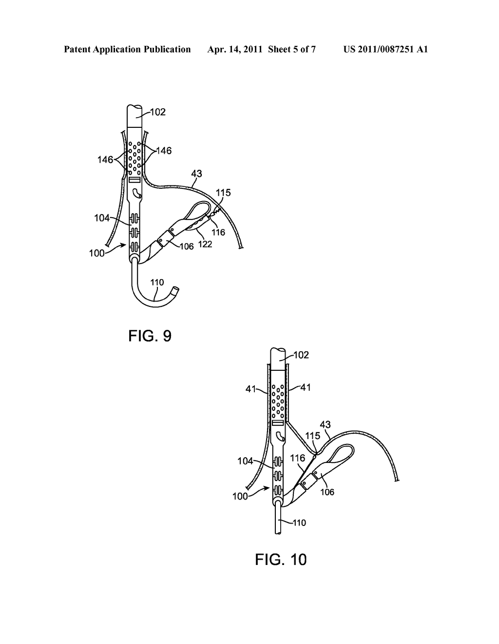 APPARATUS AND METHOD FOR MANIPULATING STOMACH TISSUE AND TREATING GASTROESOPHAGEAL REFLUX DISEASE - diagram, schematic, and image 06