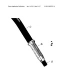 Anastomosis Device diagram and image