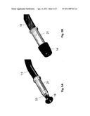 Anastomosis Device diagram and image