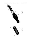 Anastomosis Device diagram and image