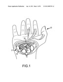 SYSTEMS AND METHODS FOR TREATMENT OF COMPRESSED NERVES diagram and image