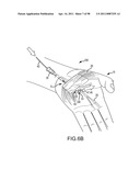 SYSTEMS AND METHODS FOR TREATMENT OF COMPRESSED NERVES diagram and image