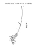 SYSTEMS AND METHODS FOR TREATMENT OF COMPRESSED NERVES diagram and image