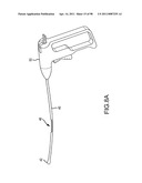 SYSTEMS AND METHODS FOR TREATMENT OF COMPRESSED NERVES diagram and image