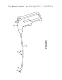 SYSTEMS AND METHODS FOR TREATMENT OF COMPRESSED NERVES diagram and image