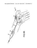 SYSTEMS AND METHODS FOR TREATMENT OF COMPRESSED NERVES diagram and image