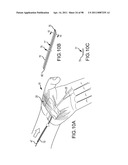 SYSTEMS AND METHODS FOR TREATMENT OF COMPRESSED NERVES diagram and image