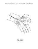 SYSTEMS AND METHODS FOR TREATMENT OF COMPRESSED NERVES diagram and image