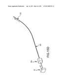 SYSTEMS AND METHODS FOR TREATMENT OF COMPRESSED NERVES diagram and image