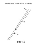 SYSTEMS AND METHODS FOR TREATMENT OF COMPRESSED NERVES diagram and image