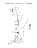 SYSTEMS AND METHODS FOR TREATMENT OF COMPRESSED NERVES diagram and image