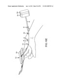 SYSTEMS AND METHODS FOR TREATMENT OF COMPRESSED NERVES diagram and image