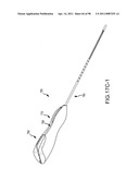 SYSTEMS AND METHODS FOR TREATMENT OF COMPRESSED NERVES diagram and image