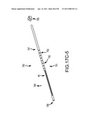 SYSTEMS AND METHODS FOR TREATMENT OF COMPRESSED NERVES diagram and image