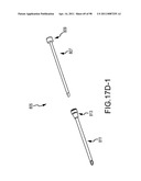 SYSTEMS AND METHODS FOR TREATMENT OF COMPRESSED NERVES diagram and image