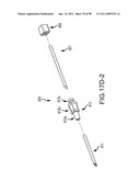 SYSTEMS AND METHODS FOR TREATMENT OF COMPRESSED NERVES diagram and image