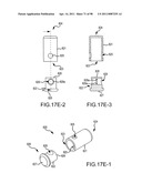 SYSTEMS AND METHODS FOR TREATMENT OF COMPRESSED NERVES diagram and image