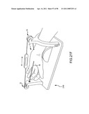 SYSTEMS AND METHODS FOR TREATMENT OF COMPRESSED NERVES diagram and image