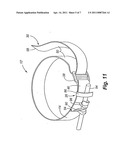 Tourniquet and Method of Use diagram and image