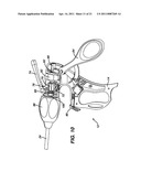 ARTICULABLE LAPAROSCOPIC INSTRUMENT diagram and image