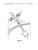 ARTICULABLE LAPAROSCOPIC INSTRUMENT diagram and image