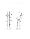 ARTICULABLE LAPAROSCOPIC INSTRUMENT diagram and image