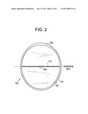 Vasculature Closure Devices and Methods diagram and image