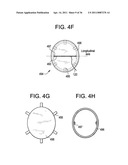 Vasculature Closure Devices and Methods diagram and image