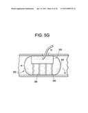 Vasculature Closure Devices and Methods diagram and image