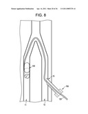 Vasculature Closure Devices and Methods diagram and image