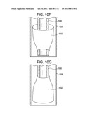 Vasculature Closure Devices and Methods diagram and image