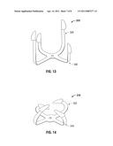 Shape Memory Fasteners And Method Of Use diagram and image